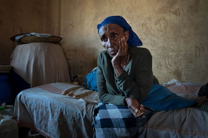 Hambre refugiados de Tigray, Etiopía
