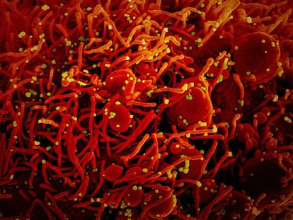 Partículas de vírus SARS-CoV-2 (em amarelo) infectando uma célula apoptótica, colorida de vermelho.